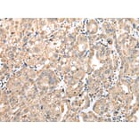 Immunohistochemistry - GM2A Antibody from Signalway Antibody (42969) - Antibodies.com