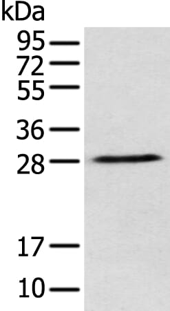 Gel: 12% SDS-PAGE Lysate: 40 &#956;g Lane: K562 cell Primary antibody: 1/250 dilution Secondary antibody: Goat anti rabbit IgG at 1/8000 dilution Exposure time: 30 seconds
