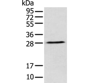 DENR Antibody from Signalway Antibody (42971) - Antibodies.com