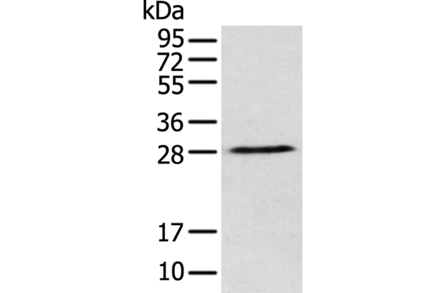 DENR Antibody from Signalway Antibody (42971) - Antibodies.com