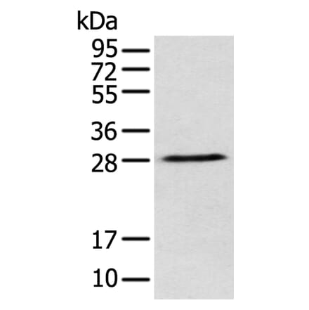 DENR Antibody from Signalway Antibody (42971) - Antibodies.com