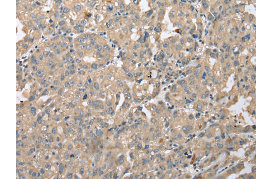 Immunohistochemistry - DENR Antibody from Signalway Antibody (42971) - Antibodies.com