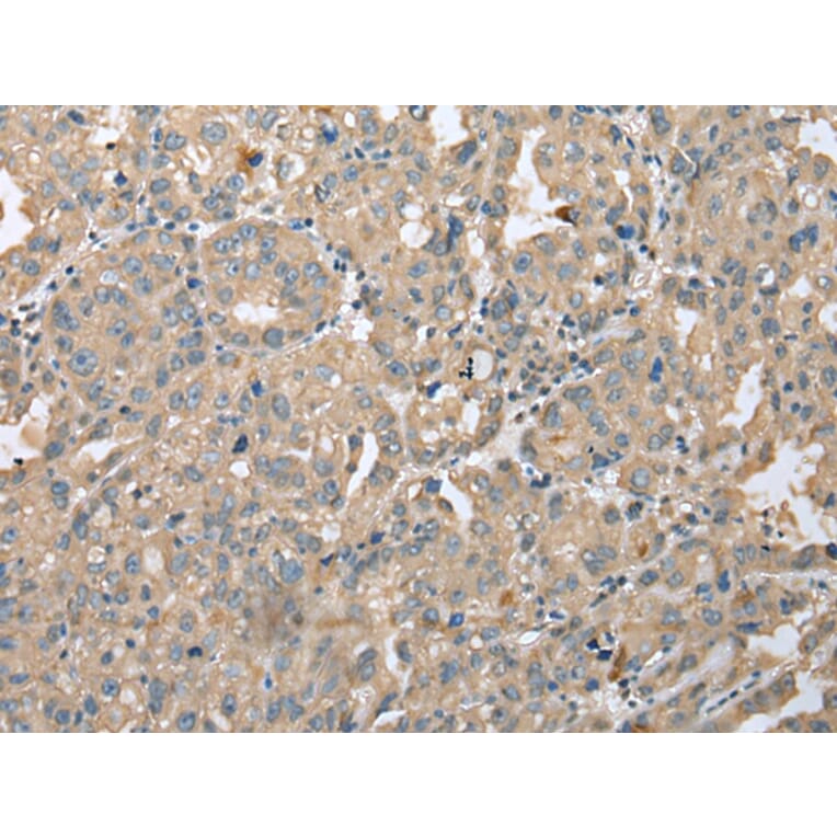 Immunohistochemistry - DENR Antibody from Signalway Antibody (42971) - Antibodies.com
