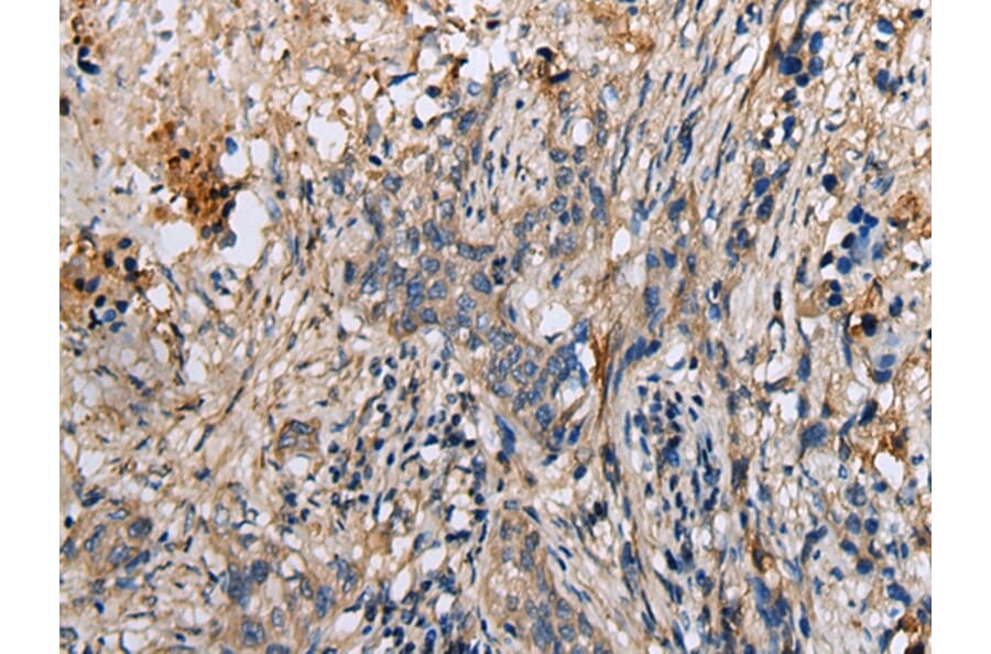 Immunohistochemistry - DENR Antibody from Signalway Antibody (42971) - Antibodies.com