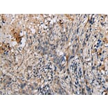 Immunohistochemistry - DENR Antibody from Signalway Antibody (42971) - Antibodies.com