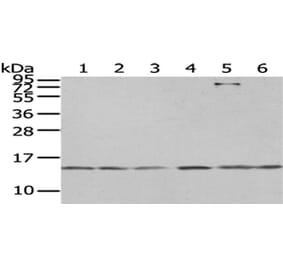 RBX1 Antibody from Signalway Antibody (43007) - Antibodies.com