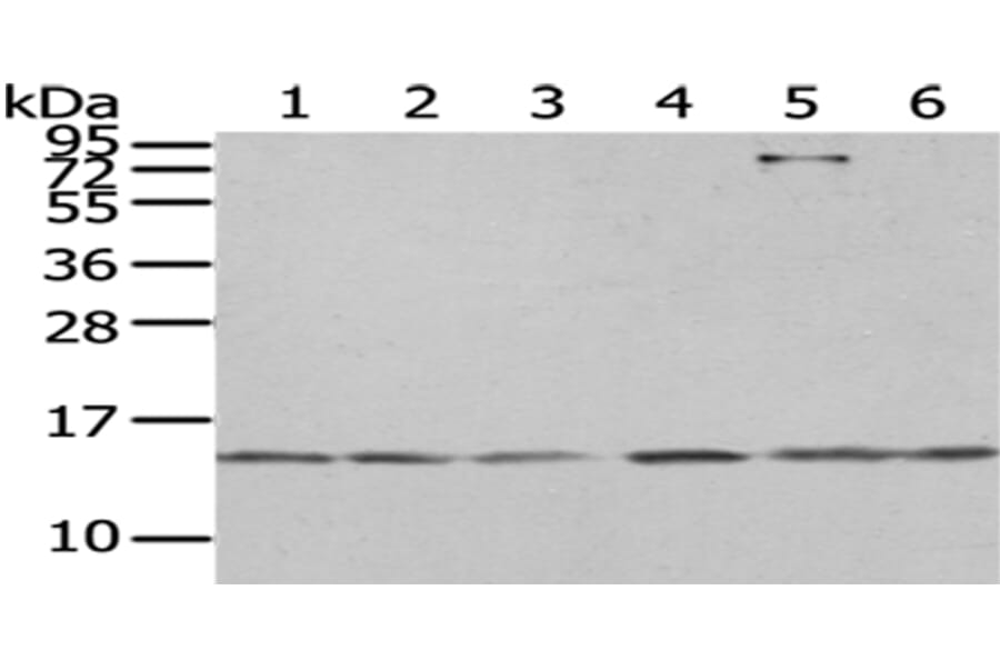 RBX1 Antibody from Signalway Antibody (43007) - Antibodies.com
