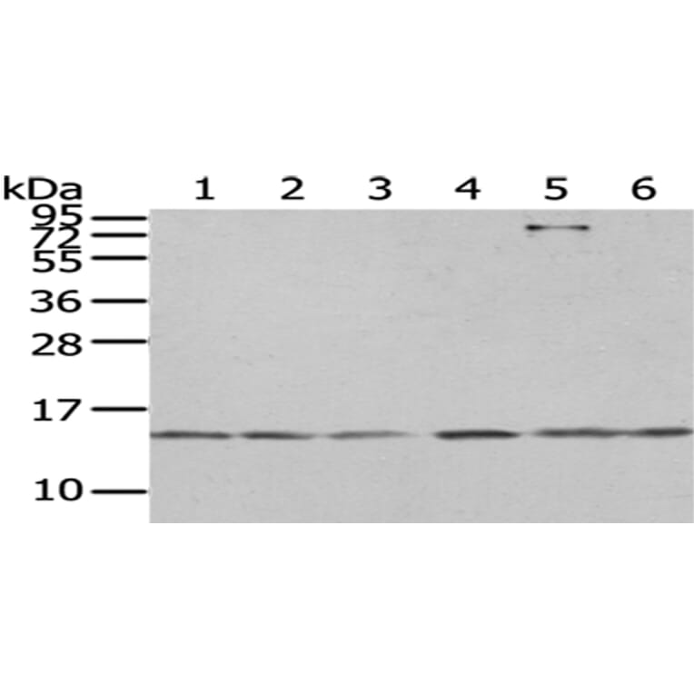 RBX1 Antibody from Signalway Antibody (43007) - Antibodies.com