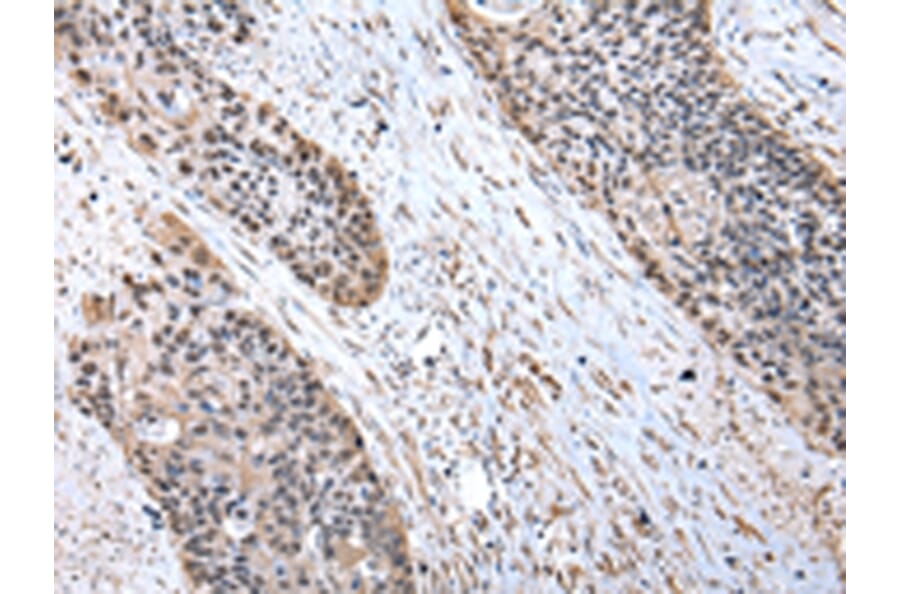 Immunohistochemistry - RBX1 Antibody from Signalway Antibody (43007) - Antibodies.com
