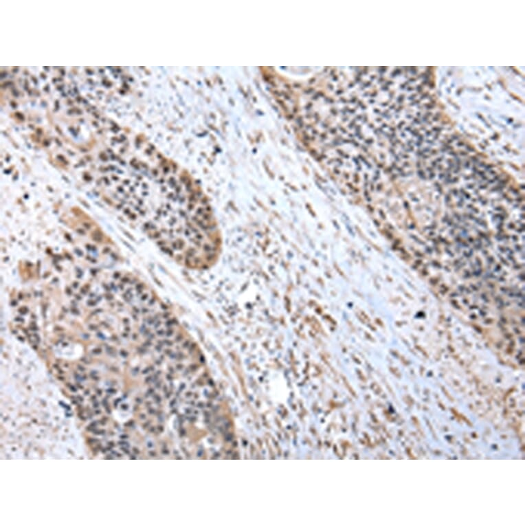 Immunohistochemistry - RBX1 Antibody from Signalway Antibody (43007) - Antibodies.com