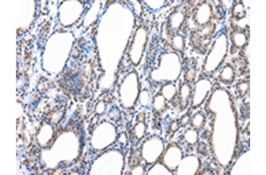 Immunohistochemistry - RBX1 Antibody from Signalway Antibody (43007) - Antibodies.com
