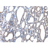 Immunohistochemistry - RBX1 Antibody from Signalway Antibody (43007) - Antibodies.com