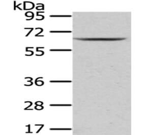 PKLR Antibody from Signalway Antibody (43010) - Antibodies.com