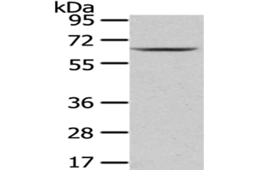 PKLR Antibody from Signalway Antibody (43010) - Antibodies.com