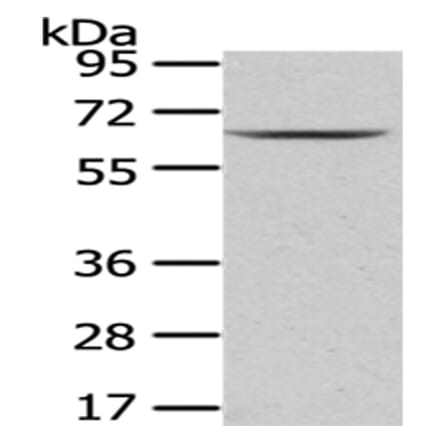 PKLR Antibody from Signalway Antibody (43010) - Antibodies.com