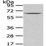 PKLR Antibody from Signalway Antibody (43010) - Antibodies.com