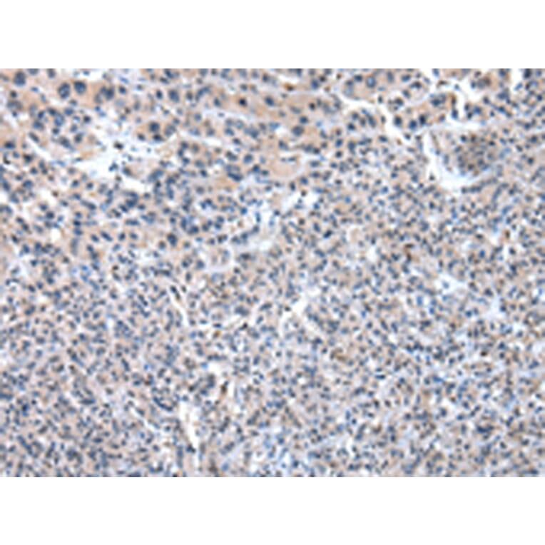 Immunohistochemistry - PKLR Antibody from Signalway Antibody (43010) - Antibodies.com