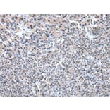 Immunohistochemistry - PKLR Antibody from Signalway Antibody (43010) - Antibodies.com