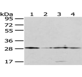 TFAM Antibody from Signalway Antibody (43011) - Antibodies.com