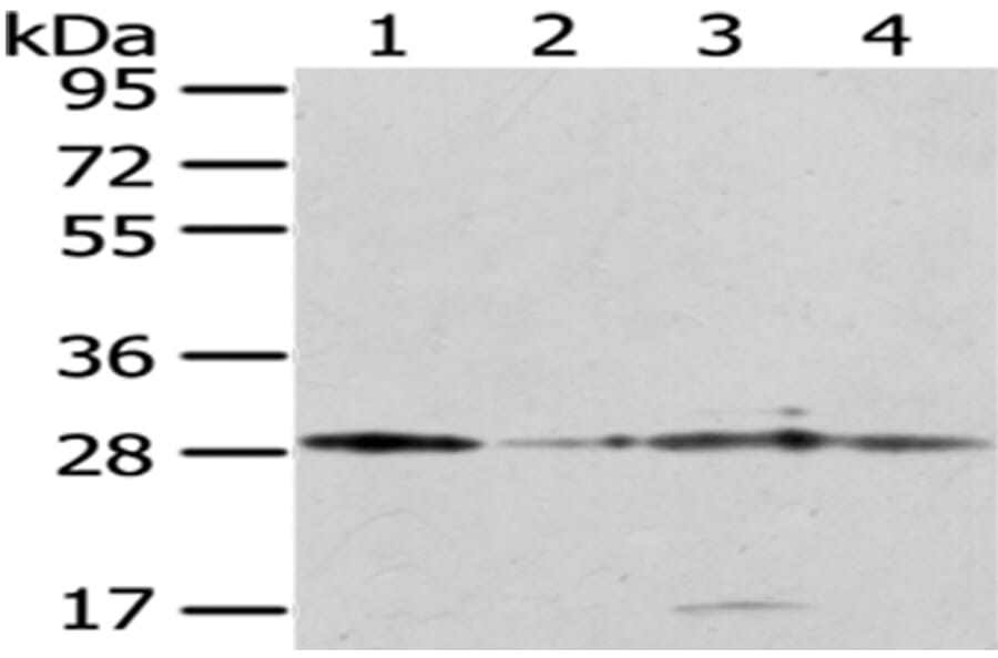 TFAM Antibody from Signalway Antibody (43011) - Antibodies.com