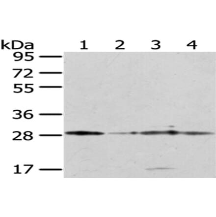 TFAM Antibody from Signalway Antibody (43011) - Antibodies.com