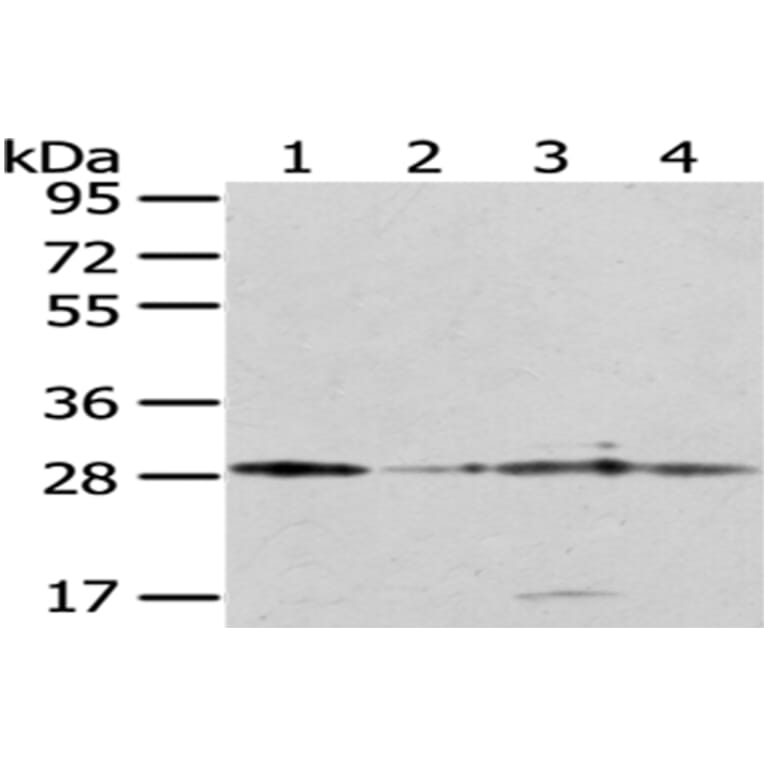 TFAM Antibody from Signalway Antibody (43011) - Antibodies.com