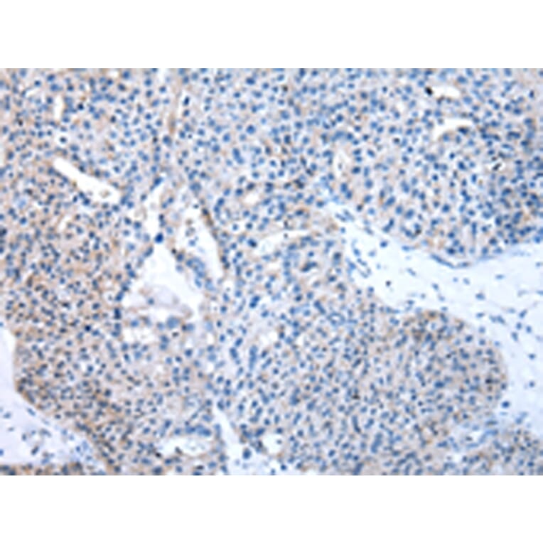 Immunohistochemistry - TFAM Antibody from Signalway Antibody (43011) - Antibodies.com