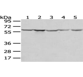TCP1 Antibody from Signalway Antibody (43013) - Antibodies.com