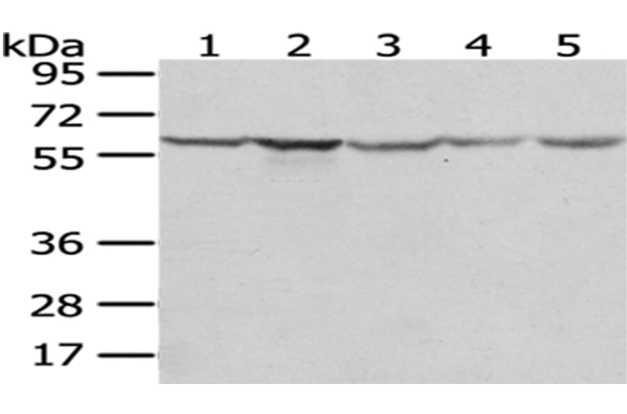 TCP1 Antibody from Signalway Antibody (43013) - Antibodies.com