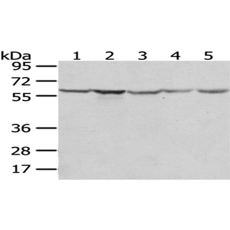 TCP1 Antibody from Signalway Antibody (43013) - Antibodies.com