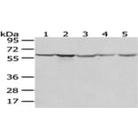 TCP1 Antibody from Signalway Antibody (43013) - Antibodies.com