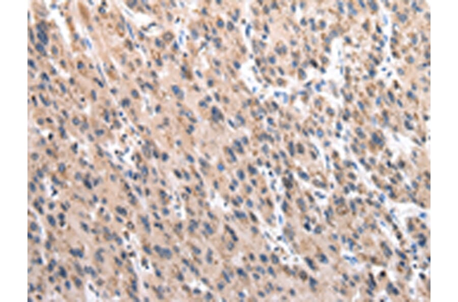 Immunohistochemistry - TCP1 Antibody from Signalway Antibody (43013) - Antibodies.com
