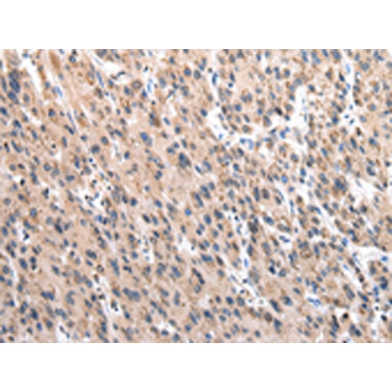 Immunohistochemistry - TCP1 Antibody from Signalway Antibody (43013) - Antibodies.com