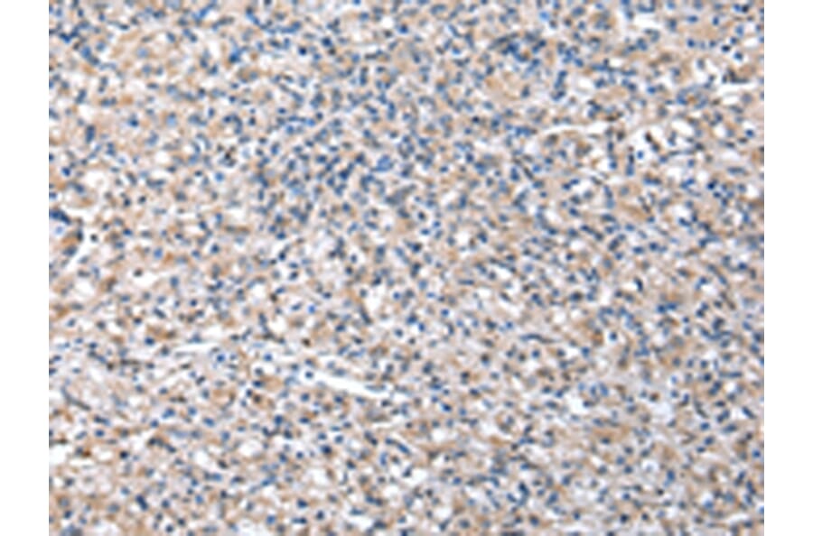 Immunohistochemistry - TCP1 Antibody from Signalway Antibody (43013) - Antibodies.com