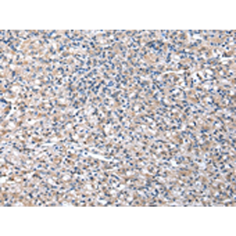 Immunohistochemistry - TCP1 Antibody from Signalway Antibody (43013) - Antibodies.com