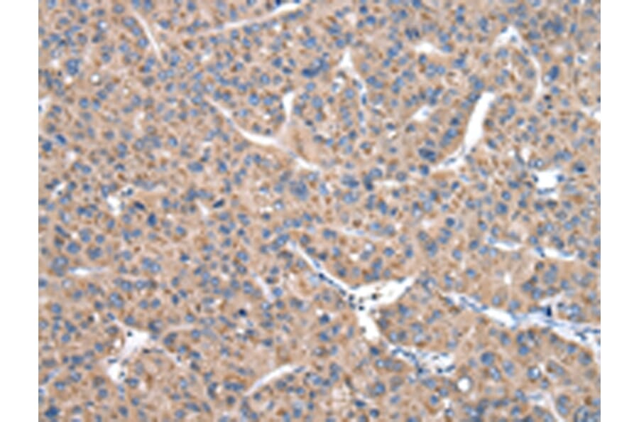 Immunohistochemistry - CASK Antibody from Signalway Antibody (43019) - Antibodies.com