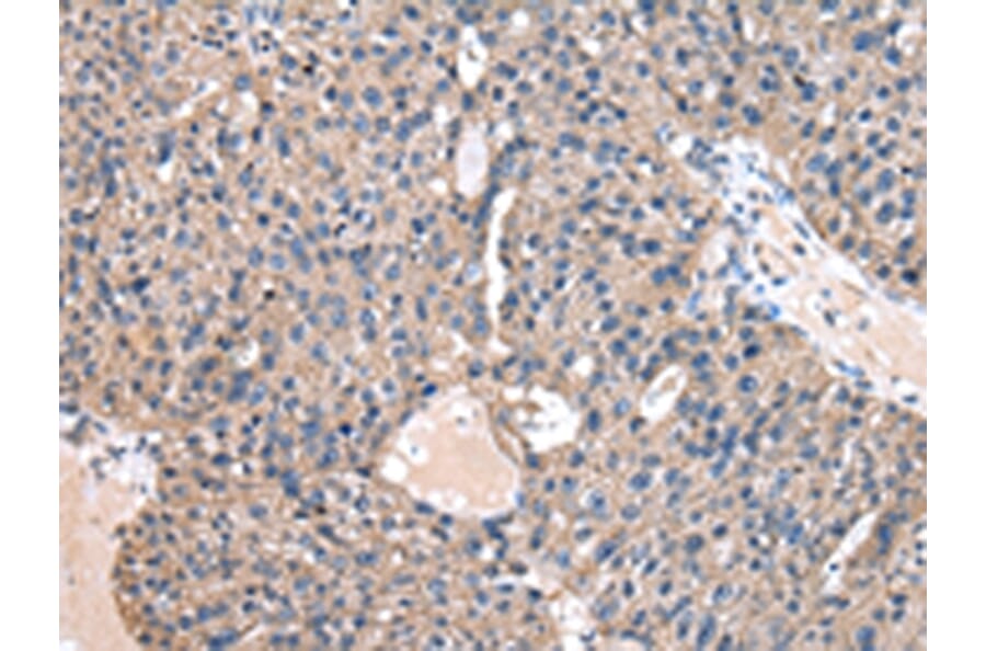 Immunohistochemistry - CASK Antibody from Signalway Antibody (43019) - Antibodies.com