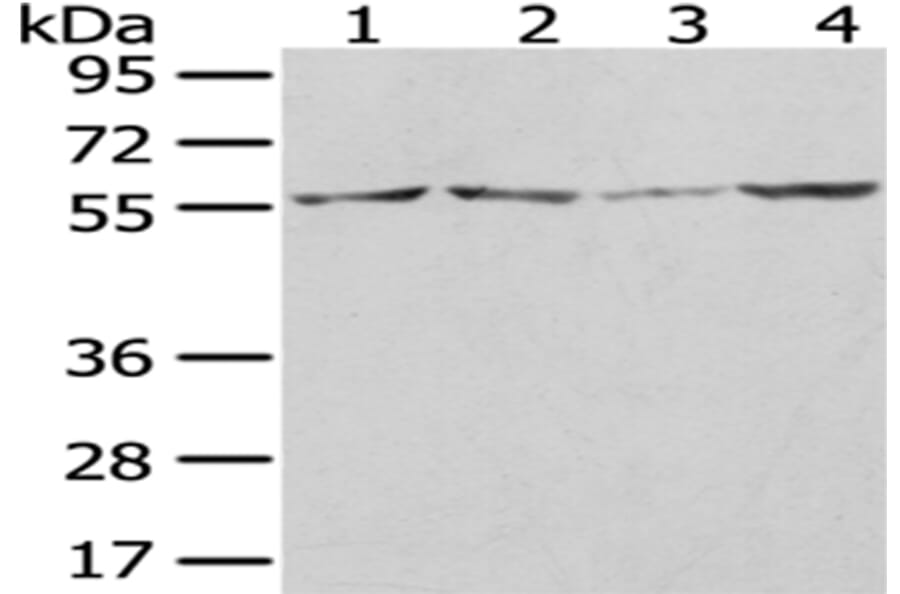 WASL Antibody from Signalway Antibody (43021) - Antibodies.com