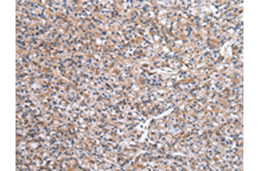 Immunohistochemistry - WASL Antibody from Signalway Antibody (43021) - Antibodies.com