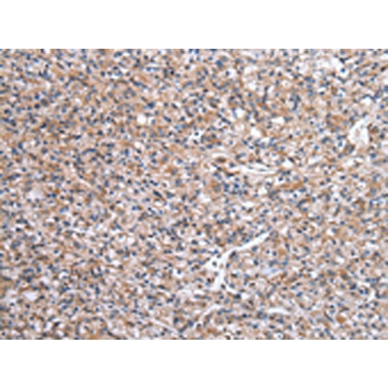 Immunohistochemistry - WASL Antibody from Signalway Antibody (43021) - Antibodies.com