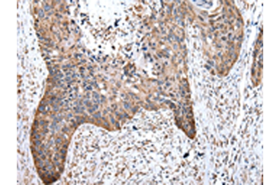 Immunohistochemistry - WASL Antibody from Signalway Antibody (43021) - Antibodies.com