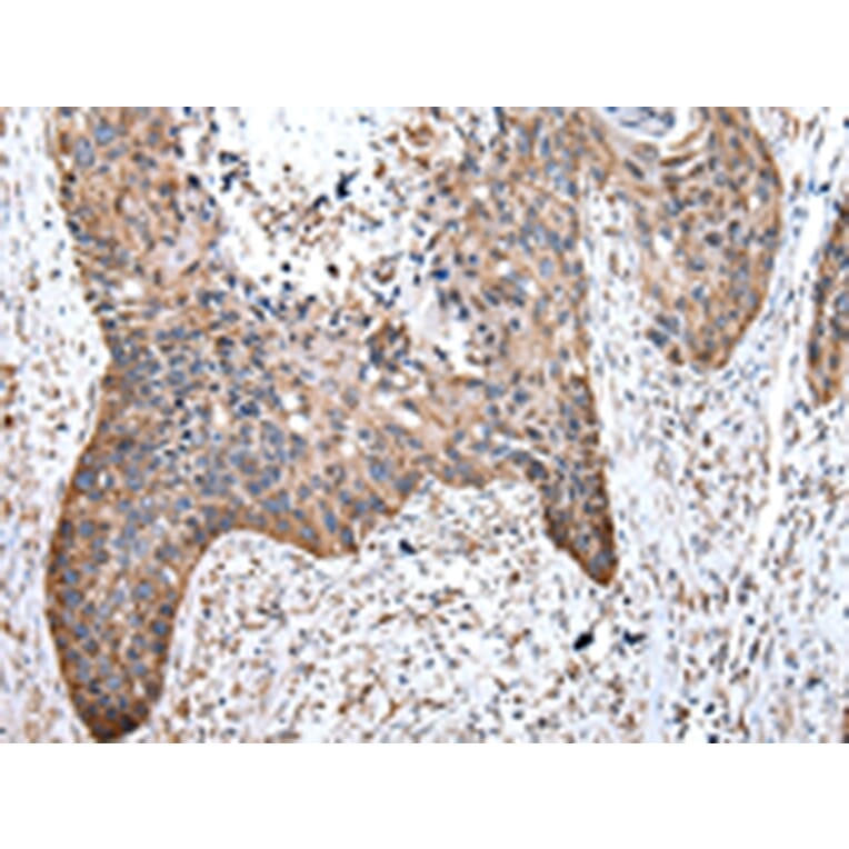 Immunohistochemistry - WASL Antibody from Signalway Antibody (43021) - Antibodies.com