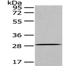 PRNP Antibody from Signalway Antibody (43022) - Antibodies.com