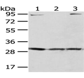 GCLM Antibody from Signalway Antibody (43024) - Antibodies.com