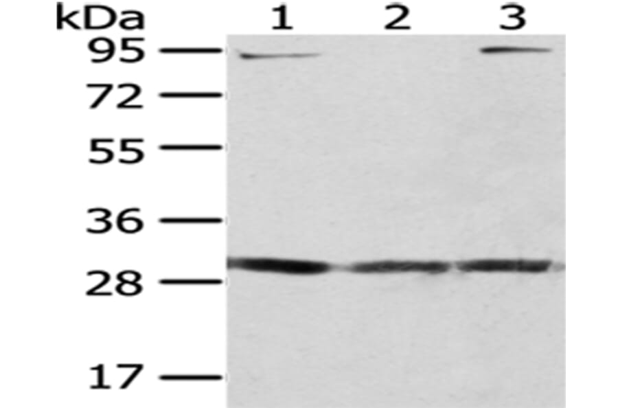 GCLM Antibody from Signalway Antibody (43024) - Antibodies.com