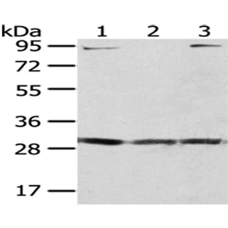 GCLM Antibody from Signalway Antibody (43024) - Antibodies.com