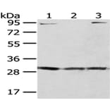 GCLM Antibody from Signalway Antibody (43024) - Antibodies.com