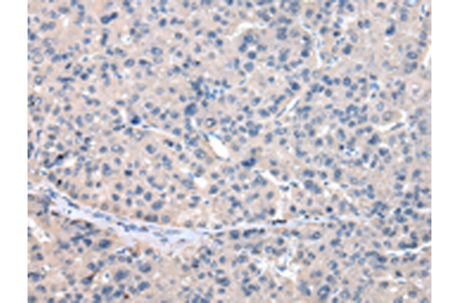 Immunohistochemistry - GCLM Antibody from Signalway Antibody (43024) - Antibodies.com