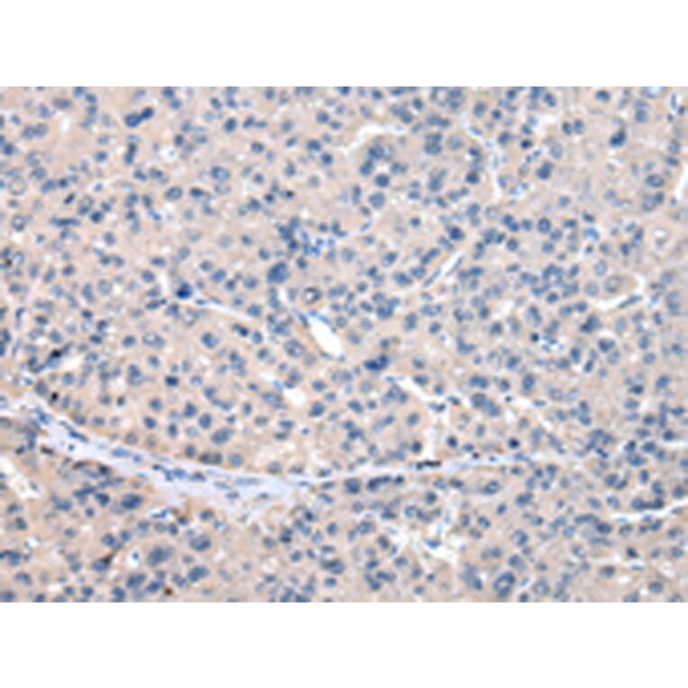 Immunohistochemistry - GCLM Antibody from Signalway Antibody (43024) - Antibodies.com