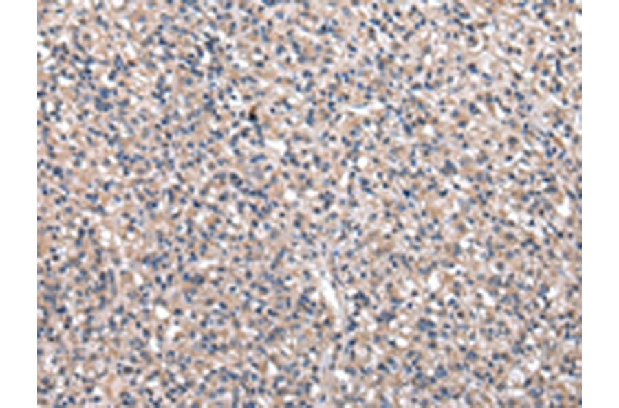 Immunohistochemistry - GCLM Antibody from Signalway Antibody (43024) - Antibodies.com